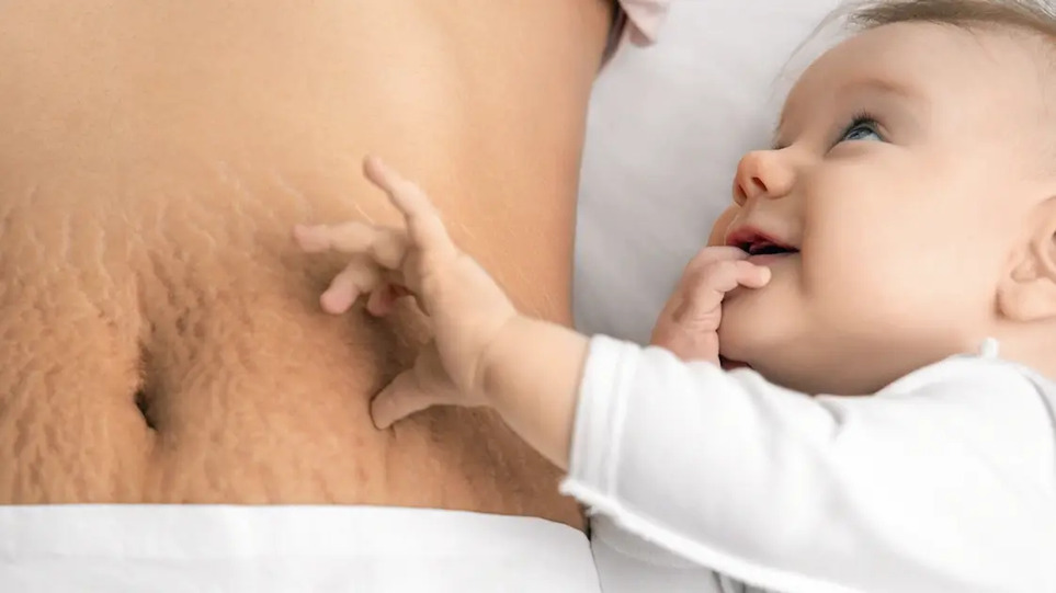 مشکلات پوستی در بارداری